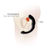 Prostate Massager (QS-037)